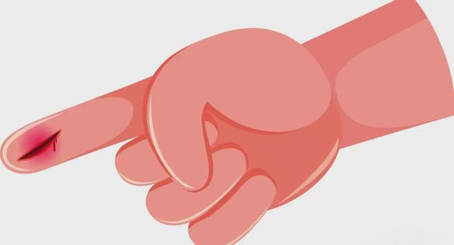 小伤口大烦恼——科学防治始于细节守护健康重在行动(图1)